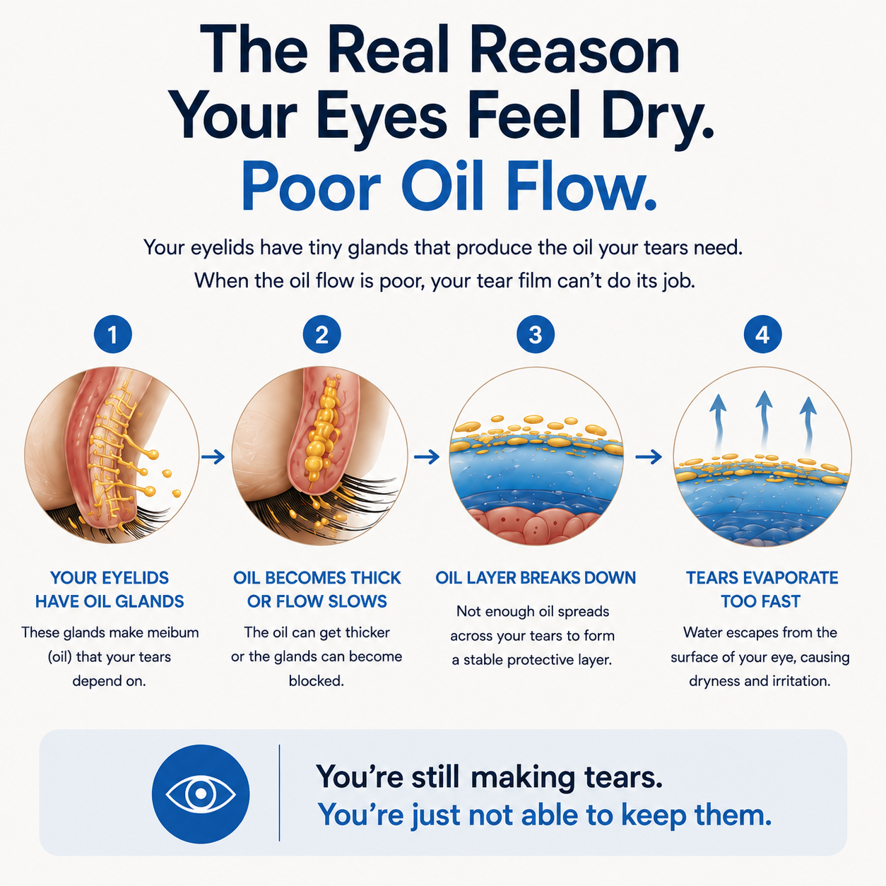 EYEMO™ Tear Film Ritual